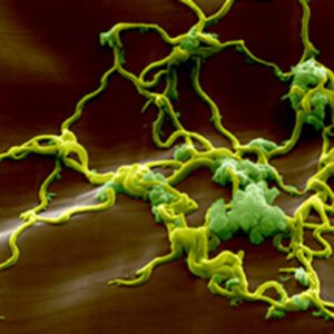 Coralie – Νόσος του Lyme τρίτο στάδιο – νευρολογικά προβλήματα – βαθιά κατάθλιψη