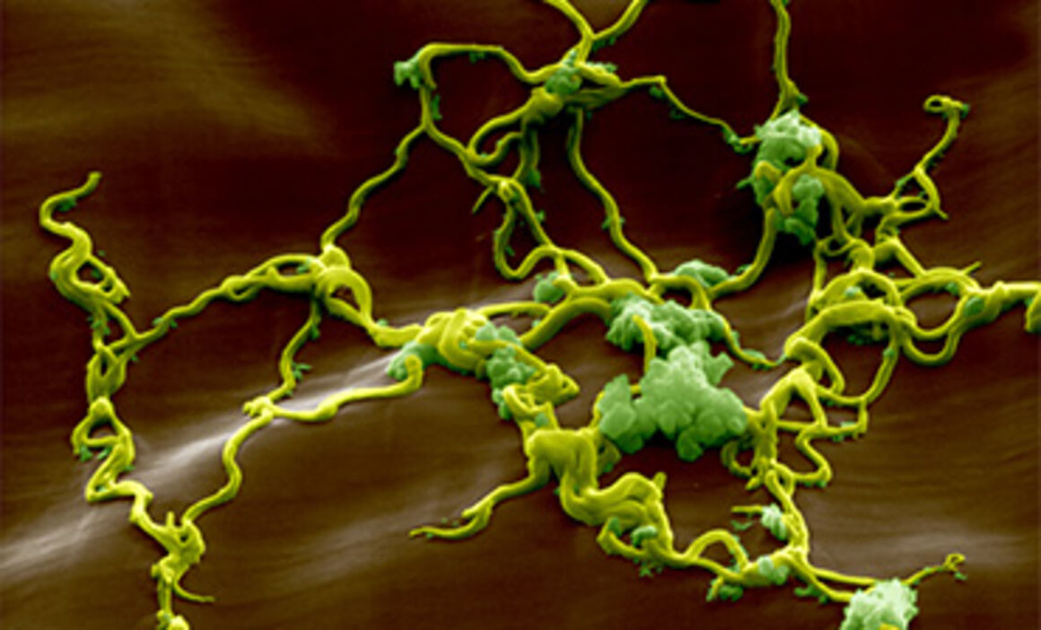 Read more about the article Coralie – Νόσος του Lyme τρίτο στάδιο – νευρολογικά προβλήματα – βαθιά κατάθλιψη
